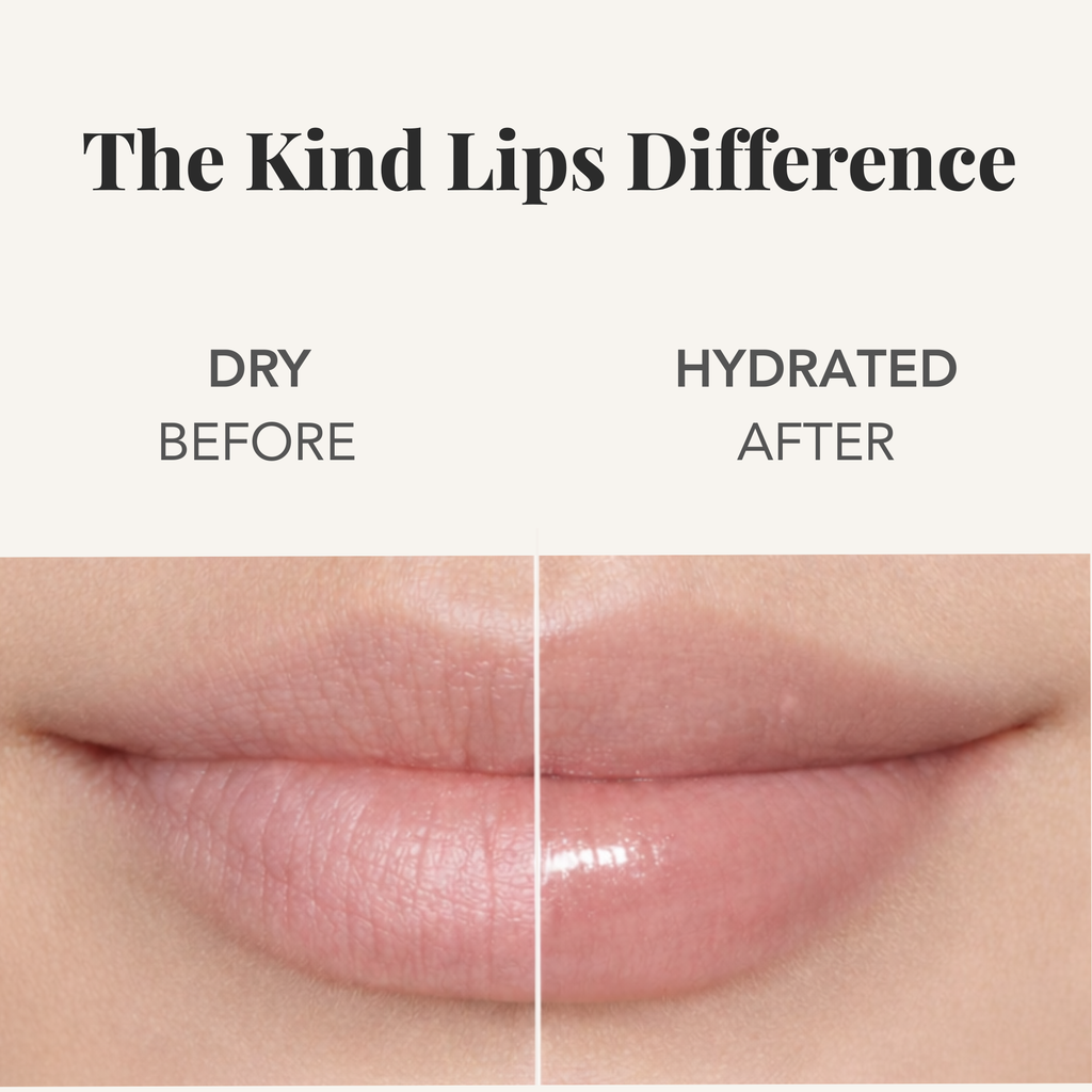 Kind Lips Organic Lip Balm Strawberry | Petroleum Free | Gluten Free | Made in USA